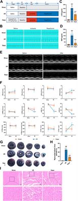 Dapagliflozin alleviates myocardial ischemia/reperfusion injury by reducing ferroptosis via MAPK signaling inhibition